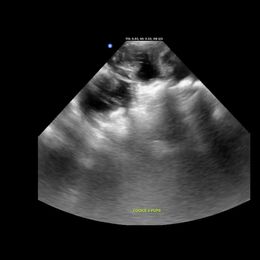 Yorkshire Terrier puppies from Mckeever's Yorkies