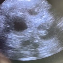 Golden Retriever puppies from Lakemist Retrievers