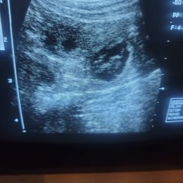 Rottweiler Puppies from Kayara Haus Rottweilers