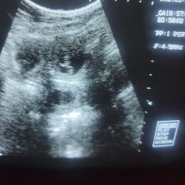 Rottweiler Puppies from Kayara Haus Rottweilers