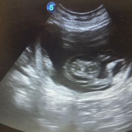 Bulldog puppies from Bull Mountain Bulldogs