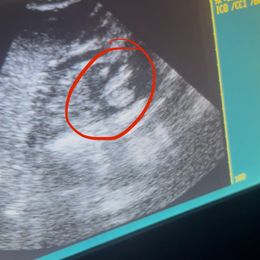 German Shepherd puppies from Di casa Esperanza