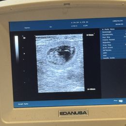 Poodle puppies from Chiaroscuro Kennel