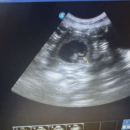 Miniature Schnauzer puppies from Butterleaf Farms