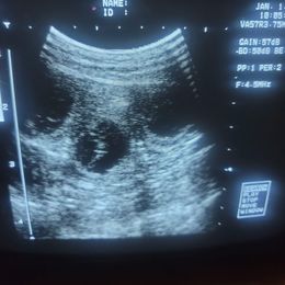 Rottweiler Puppies from Kayara Haus Rottweilers