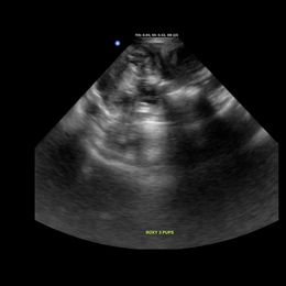 Yorkshire Terrier puppies from Mckeever's Yorkies