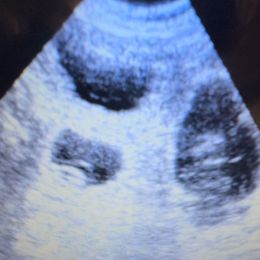 Poodle puppies from Poo's Doo's & Inu's