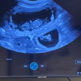 Dachshund Puppies from Long Little Doggies