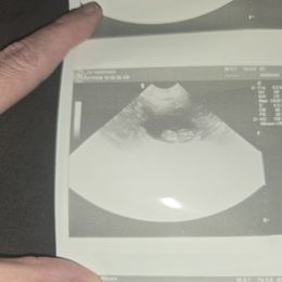 Rottweiler puppies from Vom Haus Bradford